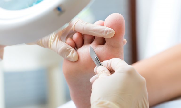 Woman receiving podiatry treatment in a Day Spa